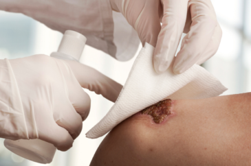 The Wound Pros business image in Marina Del Rey, CA